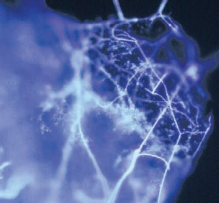Soil and dust particles are often colonized by fungal hyphae (white filaments in image); spores and bacteria are also found on dust particles.